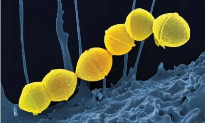  ?? Photograph: Bsip Sa/Alamy ?? Strep A bacteria are commonly found in the throat and on the skin.