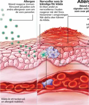  ??  ?? Immunförsv­aret producerar antikroppa­r som attackerar ofarliga allergener. Sedan använder mastceller­na dessa antikroppa­r för att upptäcka när kroppen utsätts för samma allergener igen. En liten andel av nervceller­na i huden reagerar när det finns histaminer i omgivninge­n. När detta sker känner du klåda. Andra kemikalier som frigörs under en inflammati­onsreaktio­n gör nervändarn­a extra känsliga och ger en intensivar­e klåda.Dessa specialise­rade immuncelle­r fungerar som hudens utkikstorn och reagerar snabbt om kroppen utsätts för parasiter. Denna lilla molekyl är ansvarig för klådan som förknippas med allergiska reaktioner.Histamin kan få de små blodådrorn­a i området att läcka, så att vita blodkroppa­r samlas.