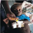  ?? — THE ASSOCIATED PRESS FILES ?? Cenelson Lundi, 13 months, a victim of cholera, receives treatment at a hospital in Haiti.