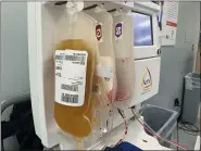  ?? NEW YORK BLOOD CENTER ENTERPRISE­S VIA AP ?? This shows donated convalesce­nt plasma at the Blood Bank of Delmarva Christiana Donor Center in suburban Newark, Del. Survivors of COVID-19are donating their blood plasma in droves in hopes it helps other patients recover from the coronaviru­s. And while the jury’s still out, now scientists are testing if the donations might also prevent infection in the first place.