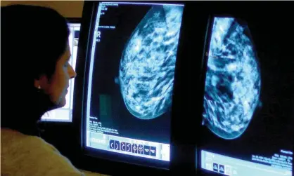  ?? Photograph: Rui Vieira/PA ?? Breast cancer is the most common form of cancer, but survival rates are generally good.