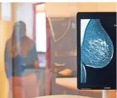  ?? FOTO: DPA ?? Die gesunde Brust einer Frau ist auf einer Röntgenauf­nahme zu sehen.