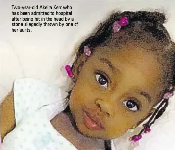  ??  ?? Two-year-old Akeira Kerr who has been admitted to hospital after being hit in the head by a stone allegedly thrown by one of her aunts.