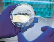  ?? ANTONIO PEREZ/CHICAGO TRIBUNE ?? Medical technologi­st II Mitan Shah looks over a cultural plate as he performs a testing process in the microbiolo­gy/virology lab for Candida auris Friday at Stroger Hospital in Chicago.