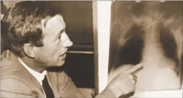  ??  ?? CHRISTIAAN BARNARD. Explica una radiografí­a de Louis Washkansky, el primer transplant­ado de corazón exitoso.