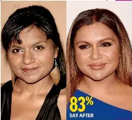 Mindy kaling 2024 plastic surgery