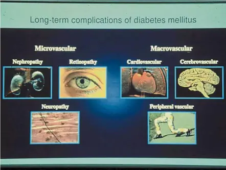  ??  ?? Diabetes can affect many different organs in the body.