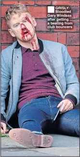  ??  ??    GRISLY: Bloodied Gary Windass after getting a beating from club bouncers