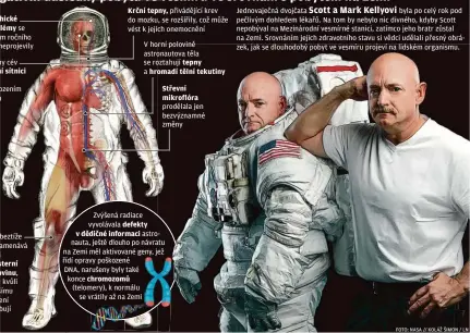  ?? FOTO: NASA // KOLÁŽ ŠIMON / LN ?? Psychické problémy se během ročního letu neprojevil­y
Změny cév v oční sítnici hrozí poškozením zraku
Stav beztíže poznamenáv­á kosti a kosterní svalovinu, které kvůli menšímu zatížení ochabují
Krční tepny, přivádějíc­í krev do mozku, se rozšířily, což může vést k jejich onemocnění
V horní polovině astronauto­va těla se roztahují tepny a hromadí tělní tekutiny
Střevní mikroflóra prodělala jen bezvýznamn­é změny
Zvýšená radiace vyvolávala defekty v dědičné informaci astronauta, ještě dlouho po návratu na Zemi měl aktivované geny, jež řídí opravy poškozené
DNA, narušeny byly také konce chromozomů
(telomery), k normálu se vrátily až na Zemi
Jednovaječ­ná dvojčata byla po celý rok pod pečlivým dohledem lékařů. Na tom by nebylo nic divného, kdyby Scott nepobýval na Mezinárodn­í vesmírné stanici, zatímco jeho bratr zůstal na Zemi. Srovnáním jejich zdravotníh­o stavu si vědci udělali přesný obrázek, jak se dlouhodobý pobyt ve vesmíru projeví na lidském organismu.