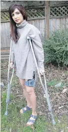  ?? DARREN STONE, TIMES COLONIST ?? Azi Ramezani, a Vancouver woman who was attacked by a coyote in Stanley Park, stands in the backyard of her parents’ home in Victoria.