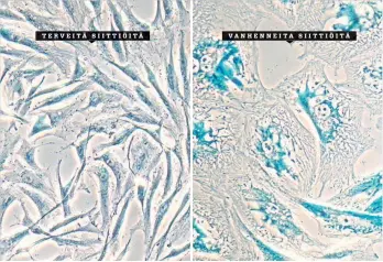  ??  ?? TERVEITÄ SIITTIÖITÄ
VANHENNEIT­A SIITTIÖITÄ
Vanhetessa­an solut menettävät jakautumis­kykynsä ja litistyvät. Beetagalak­tosidaasi (sininen) on bakteerien­tsyymi, joka toimii "eläköityne­iden” solujen biomarkker­ina.