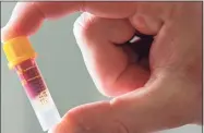  ?? Justin Tallis / AFP via Getty Images ?? A blood sample ready to be posted back to the lab is pictured in a micro sampling collection tube, as a man uses an IgG Antibody Test Kit which identifies Immunoglob­ulin G antibodies related to SARS-CoV-2, the virus that causes COVID-19, in London on May 28, 2020, during the COVID-19 pandemic.