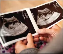  ?? ?? SCaN SCaM: Couple were sent ultrasound images