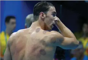  ?? MICHAEL DALDER / FOR CHINA DAILY ?? US swimmer Michael Phelps has appeared at the Rio Olympics with purple circles dotting his back and shoulder — the telltale mottling left by the ancient Chinese treatment of cupping.