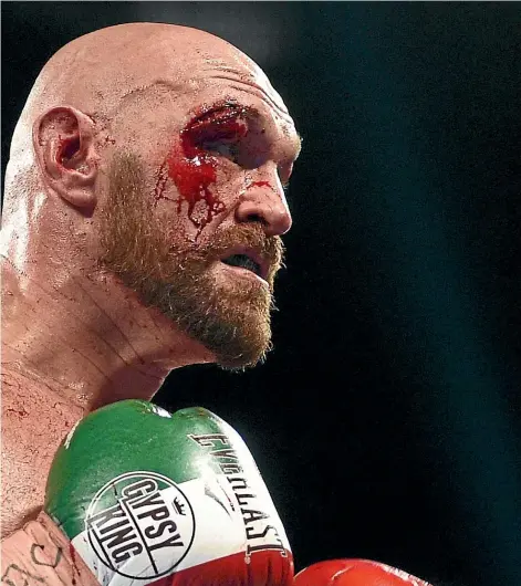  ?? GETTY IMAGES ?? A cut to the face of British heavyweigh­t Tyson Fury made for a difficult night for his corner during his fight against Otto Wallin at the weekend. Inset, New Zealander Taylor Barry works with Fury during the fight.
