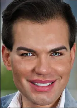  ??  ?? Living doll: Rodrigo Alves had a hair transplant and liposuctio­n