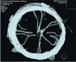  ?? COURTESY OF SÉBASTIEN BÉLANGER ?? Above: CT scan of a log infested with whitespott­ed sawyer beetle larvae. Left: White-spotted sawyer beetle. The beetles lay eggs under the bark of trees and the larvae are said to make so much noise when chewing through the wood that it sounds like a...