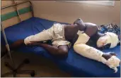  ?? HAMIDOU SAYE — THE ASSOCIATED PRESS ?? Saga Saganla, 30, from Diawely, lies on his bed at Somine Dolo hospital in Mopti, Mali, Friday.