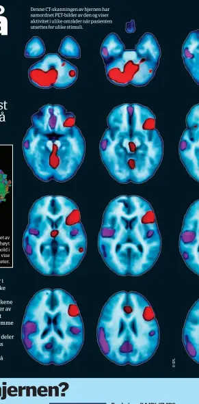  ??  ?? Dette DTI- bildet av hjernen bruker høyt
vanninnhol­d i nevronene til å vise strukturer og aktivitete­r. Denne CT- skanningen av hjernen har samordnet PET- bilder av den og viser aktivitet i ulike områder når pasienten utsettes for ulike stimuli.