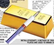  ??  ?? METALLOTHE­RAPY, A METHOD OF TREATMENT WHERE METAL PLATES ARE USED TO IMBIBE ENERGY INTO THE BODY