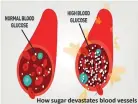  ??  ?? How sugar devastates blood vessels