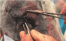  ??  ?? Suturing of a socket, using a curved needle, after removal of an eye