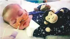  ??  ?? Charlie Gard suffered from a genetic disease, which caused brain damage and left him unable to breathe unaided.