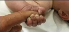  ??  ?? This Sunday photo provided by the Missoula County Sheriff’s Office shows a 5-month-old infant with dirt under their fingernail­s after authoritie­s say the baby survived about nine hours being buried under sticks and debris in the woods. MISSOULA COUNTY...