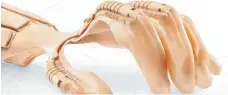  ?? FOTO: HKK BIONICS ?? So sieht die Orthese aus. Entstanden ist die Produktide­e der bionischen Handorthes­e in einem Forschungs­projekt zum Thema Handprothe­tik.