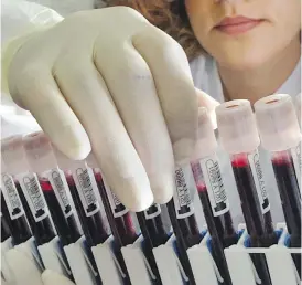  ??  ?? Scientists have developed a blood test that can detect signs of eight types of cancer before symptoms arise.