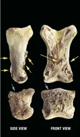  ??  ?? Rolf’s skeleton shows ringbone on the long and short pasterns of the right side. SIDE VIEW FRONT VIEW