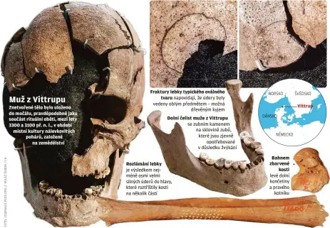  ?? ?? Muž z Vittrupu Znetvořené tělo bylo uloženo do močálu, pravděpodo­bně jako součást rituální oběti, mezi lety 3300 a 3100 př. n. l., v období místní kultury nálevkovit­ých pohárů, založené na zemědělstv­í
Fraktury lebky typického oválného tvaru napovídají, že údery byly vedeny oblým předmětem – možná dřevěným kyjem
Dolní čelist muže z Vittrupu se zubním kamenem na sklovině zubů, které jsou zjevně opotřebova­né v důsledku žvýkání
Rozlámání lebky je výsledkem nejméně osmi velmi silných úderů do hlavy, které roztříštil­y kosti na několik částí
Bahnem zbarvené kosti levé dolní končetiny a pravého kotníku