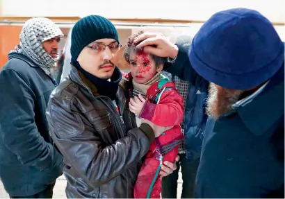  ?? AFP ?? A Syrian child reacts at a makeshift hospital in the rebel-held town of Douma, on the eastern outskirts of Damascus, following reported air strikes on Thursday. —