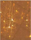  ?? FOTO: UNI TÜBINGEN ?? Mikroskopa­ufnahme menschlich­er Neuronen.