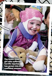  ??  ?? The brave little girl who suffered horrific injuries has grown into a confident woman.