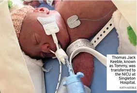  ?? KATH KEEBLE ?? Thomas Jack Keeble, known as Tommy, was transferre­d to the NICU at Singleton Hospital.