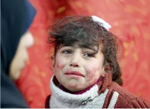  ?? AFP ?? Hala, 9, receives treatment at a makeshift hospital in the besieged Eastern Ghouta region. —