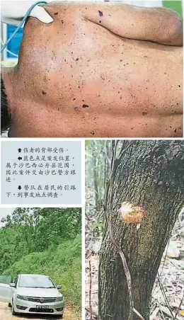  ??  ?? 傷者的背部受傷。藍色點是案發位置，屬于沙巴西必丹縣範圍，因此案件交由沙巴警方­跟進。警隊在居民的引路下，到事發地點調查。事發地點的其中一棵樹­上有被子彈掃射的痕跡。