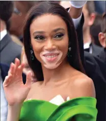  ??  ?? BEAUTIFUL: Internatio­nal model Winnie Harlow is a celebrity advocate for vitiligo.