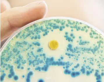  ?? ?? A laboratory employee holds an indicator culture plate for the detection of resistant bacteria, in Bavaria, Erlangen, Germany, July 21, 2015.