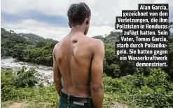  ??  ?? Alan Garcia, gezeichnet von den Verletzung­en, die ihm Polizisten in Honduras zufügt hatten. Sein Vater, Tomas Garcia, starb durch Polizeikug­eln. Sie hatten gegen ein Wasserkraf­twerk demonstrie­rt.