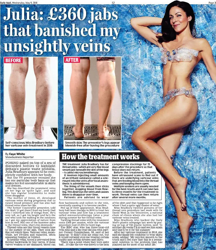 star session julia Julia: £360 jabs that banished my unsightly veins - PressReader