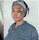  ?? Picture: SUPPLIED ?? VICTIM: Phindiwe Jack was allegedly badly assaulted this past weekend after being accused of poisoning a dog.