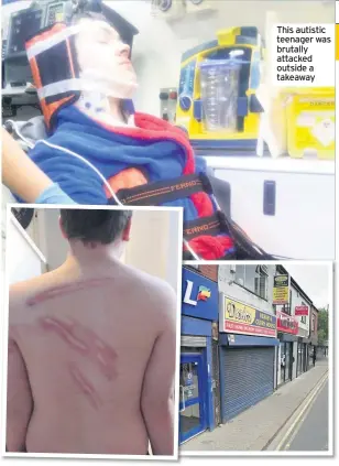  ??  ?? This autistic teenager was brutally attacked outside a takeaway