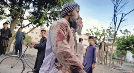  ?? EBRAHIM NOROOZI/AP ?? A blood-stained worshipper walks around the mosque where the explosion took place, in Kabul, Afghanista­n, Friday.