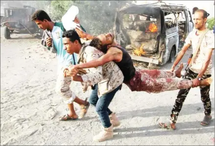  ?? SALEH AL-OBEIDI/AFP ?? Yemenis carry a wounded man past a burning vehicle following a reported suicide car bombing in Huta, the capital of the southern province of Lahj, a bastion of al-Qaeda jihadists, on March 27.