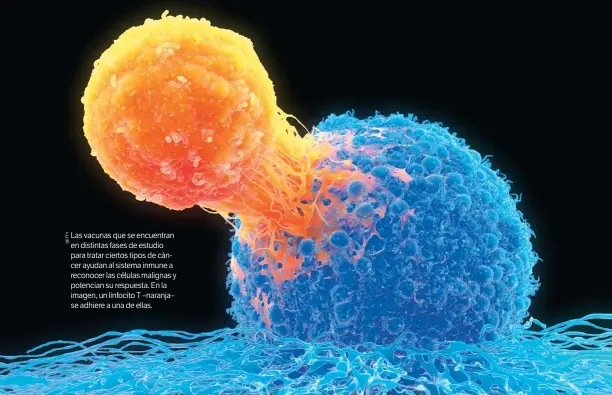  ??  ?? Las vacunas que se encuentran en distintas fases de estudio para tratar ciertos tipos de cáncer ayudan al sistema inmune a reconocer las células malignas y potencian su respuesta. En la imagen, un linfocito T –naranja– se adhiere a una de ellas.