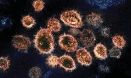  ?? Photograph: AP ?? ‘We will almost certainly see the further erosion of immune protection as the virus continues to evolve.’ Sars-CoV-2 virus particles.