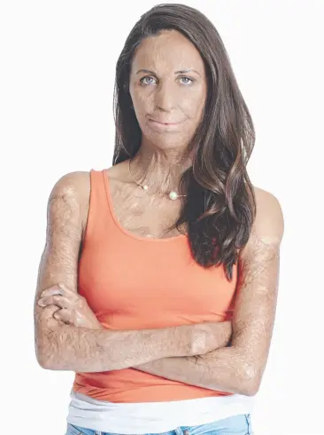  ??  ?? SPECIAL GUEST: Motivation­al speaker and athlete Turia Pitt will tell her story tonight.