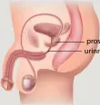  ??  ?? prostata urinrøret